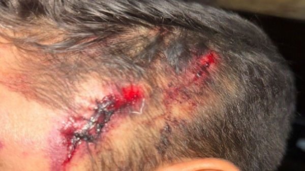 Vereador denuncia que filho foi agredido em carreata nesse sábado em Timon